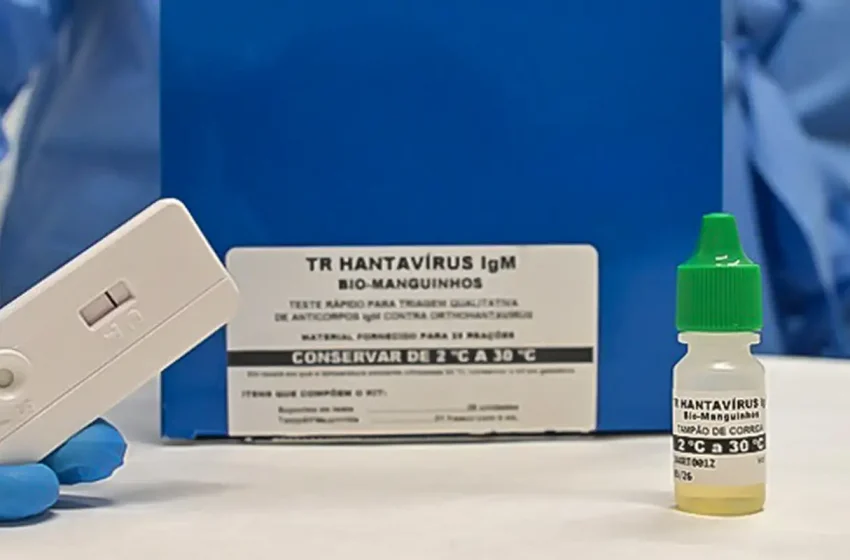  Hantavírus Andes: Brasil sem circulação da cepa de transmissão humana